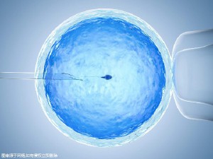 反复流产案例